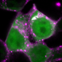 細胞内タンパク質 写真